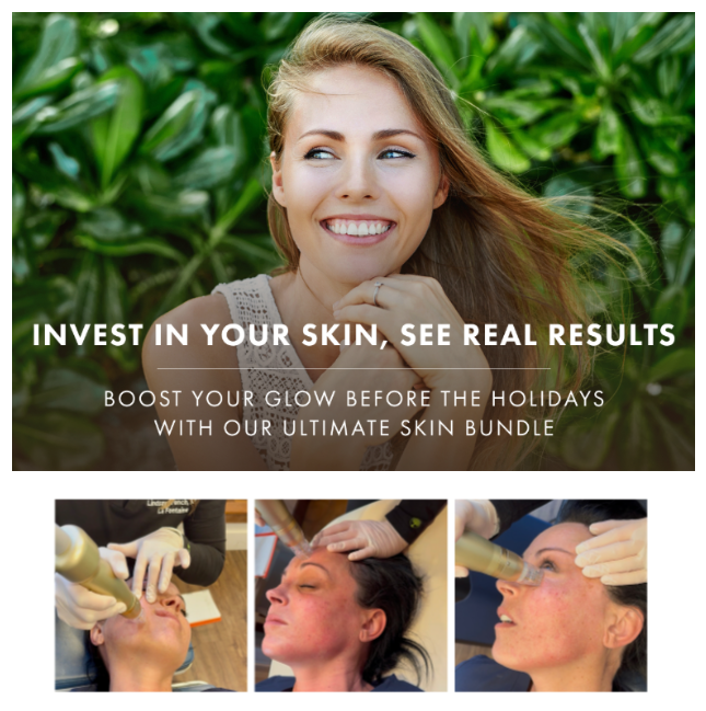 SylfirmX + Sculptra - Full Transformation Package!